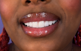Creamy Lip Butter